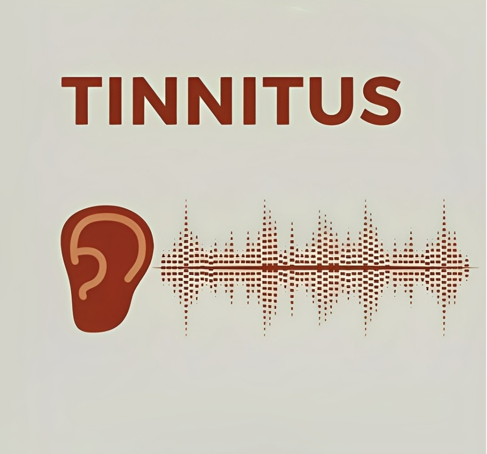 Tinnitus