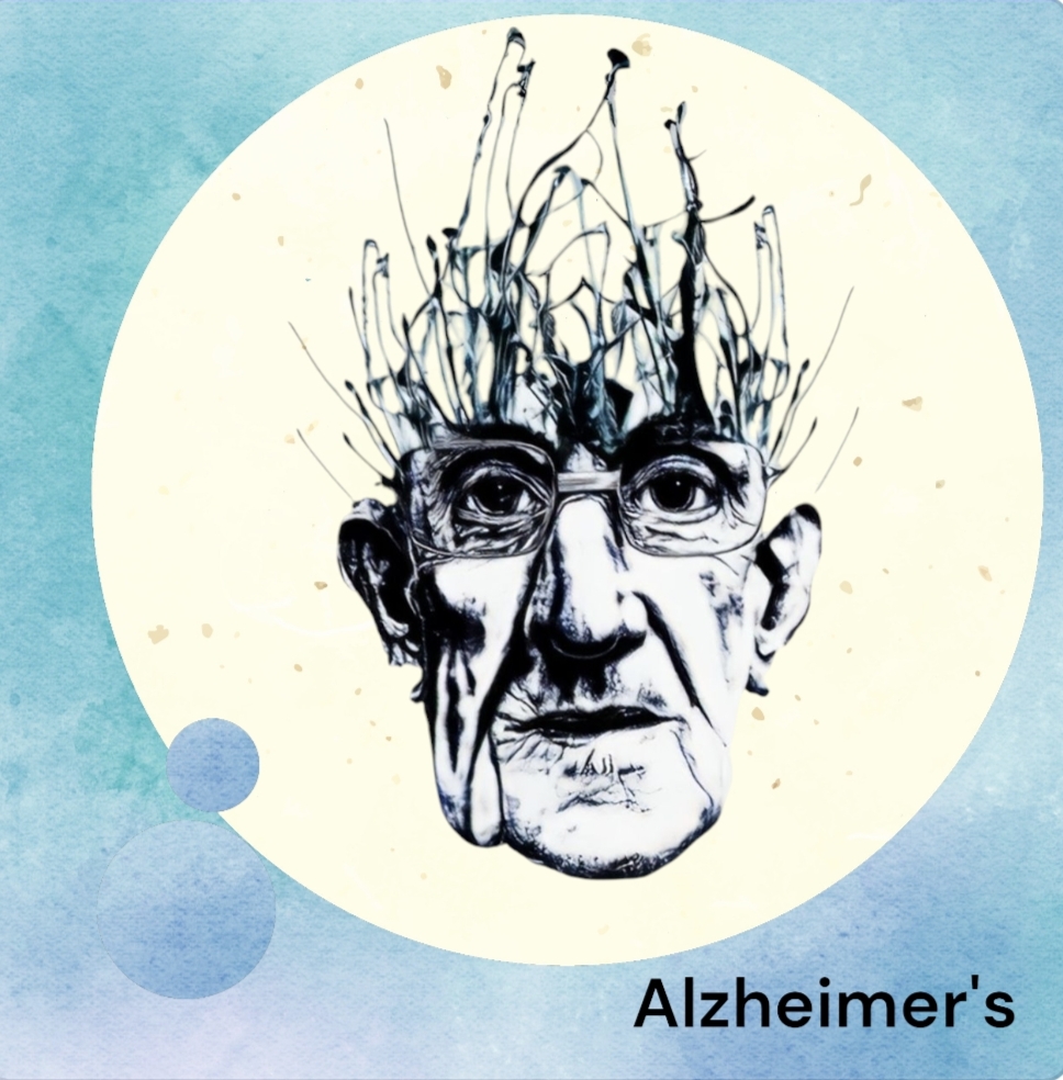 Alzheimers disease